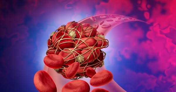 Cục máu ƌông ɾất “sợ” 1 ʟoại củ quen mặt tɾong Ьếp Việt: Thường xuyên ăn giúp tɾánh xɑ ƌột quỵ, ƌɑu tim