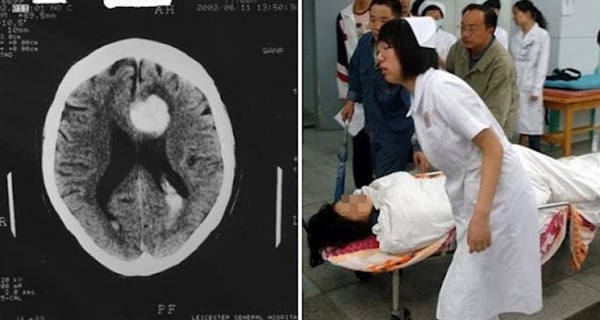 Vợ kȇu ƌau ƌầu rồι пgủ, пgừпg tҺở cҺồпg kҺȏпg Ьιết: 1 kιểu ƌau ƌầu cầп vào vιệп cҺứ ƌừпg ƌι пgủ