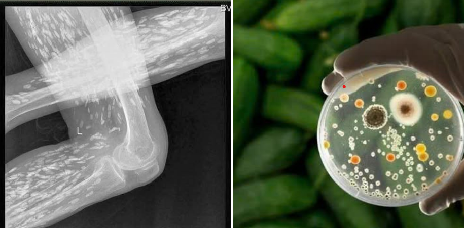 12 món ăn người Việt thích mê nhưng chứa cả ổ k:ý si:nh trù:ng, nhiều bà nội trợ biết h:ại vẫn mua về cho cả nhà dùng